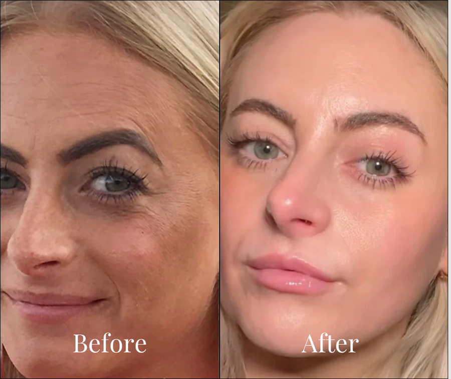 Sandra, 44 results