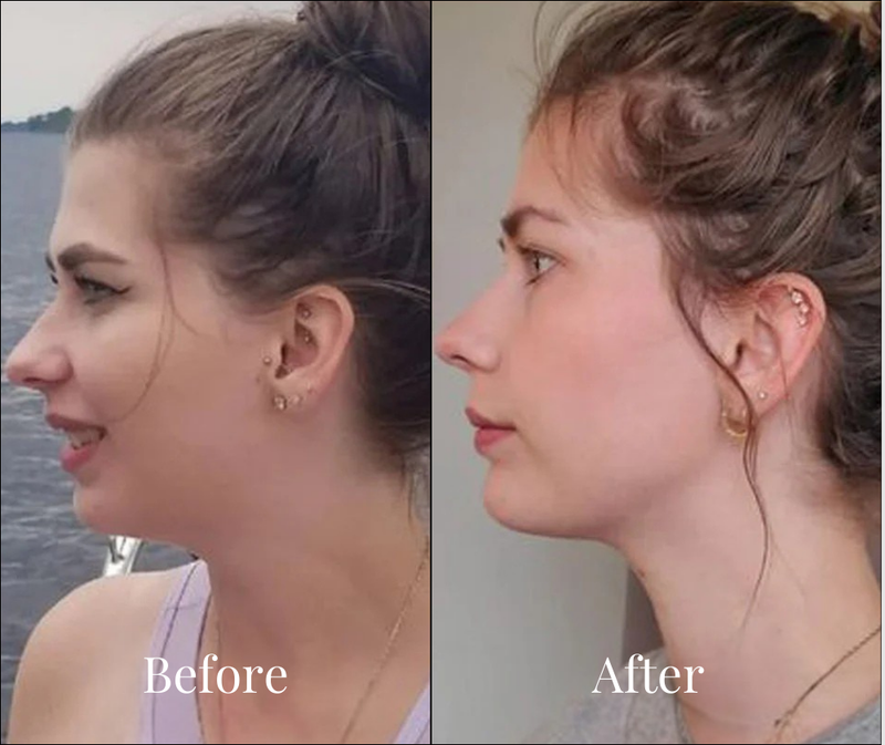 Gaëlle results