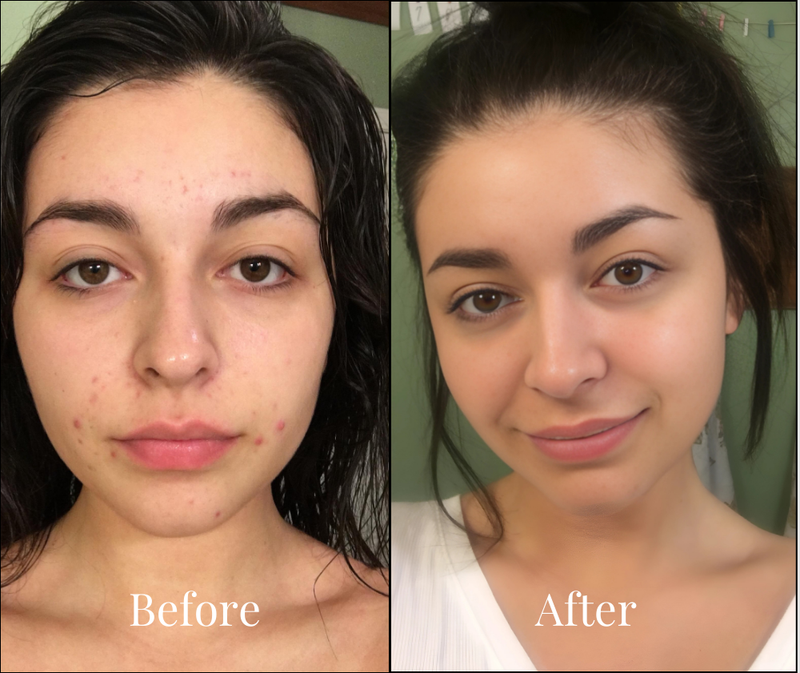 Mia, 27 results