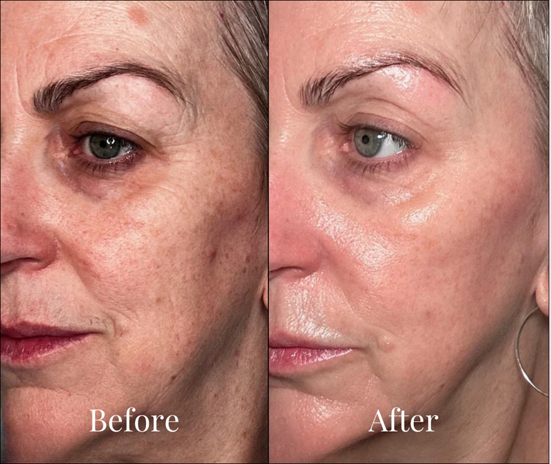 Anita results