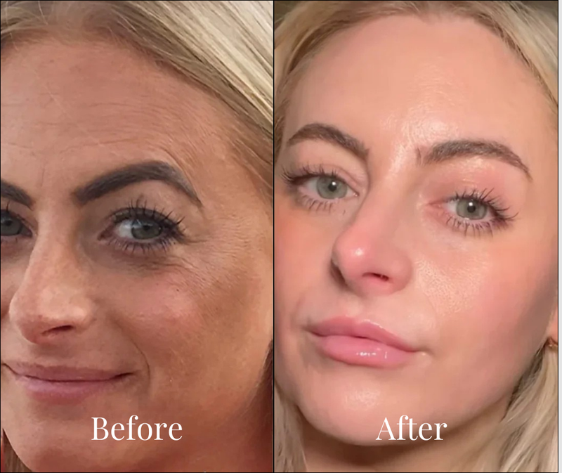 Sandra, 44 results
